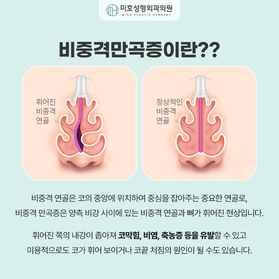 Considering Everything from the Procedure to the Cost of Septal Deviation Correction image 2