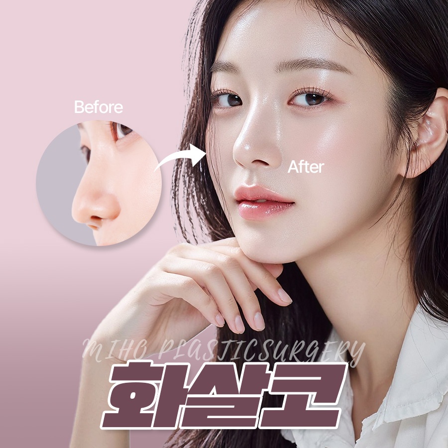 화살코 개선 전 체크리스트 6가지 관련 이미지 1