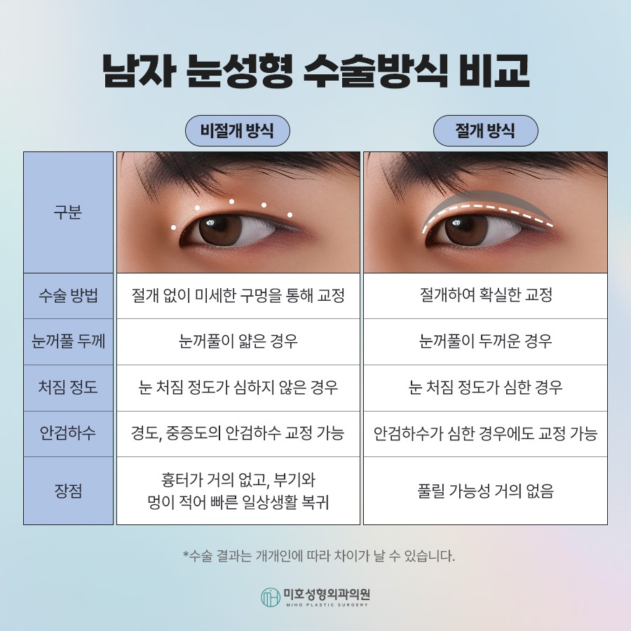 What Men Considering Double Eyelid Surgery Should Know image 4
