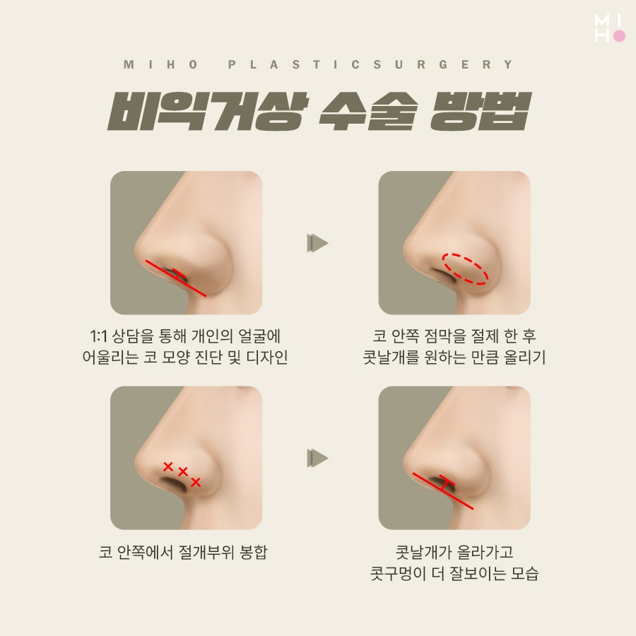 비익거상 깔끔한 과정을 위해서 관련 이미지 5