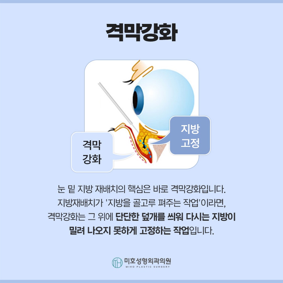 눈밑지 다크서클 처짐 고민된다면 관련 이미지 4