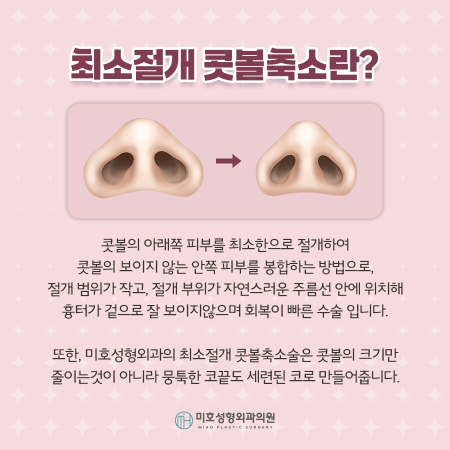 콧볼축소 자연스러운 결과로 관련 이미지 2