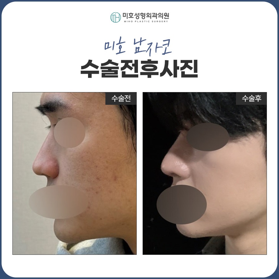 남자코 잘 맞는 이미지로 관련 이미지 10