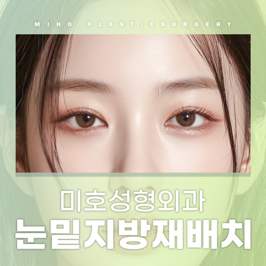 눈밑지방재배치 고민에 맞게 개선하며 관련 이미지 1