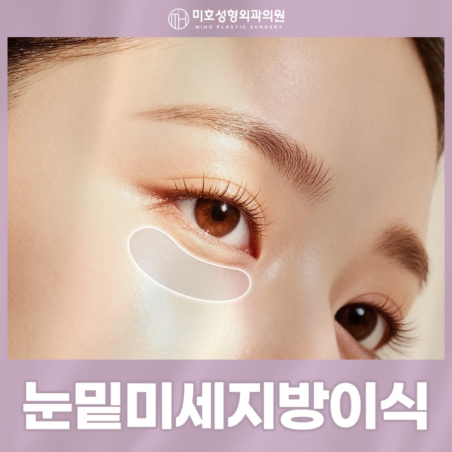 눈밑미세지방이식 올바른 계획으로 관련 이미지 1