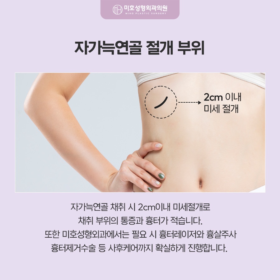 자가늑코수술 흉터와 통증이 걱정된다면 관련 이미지 5
