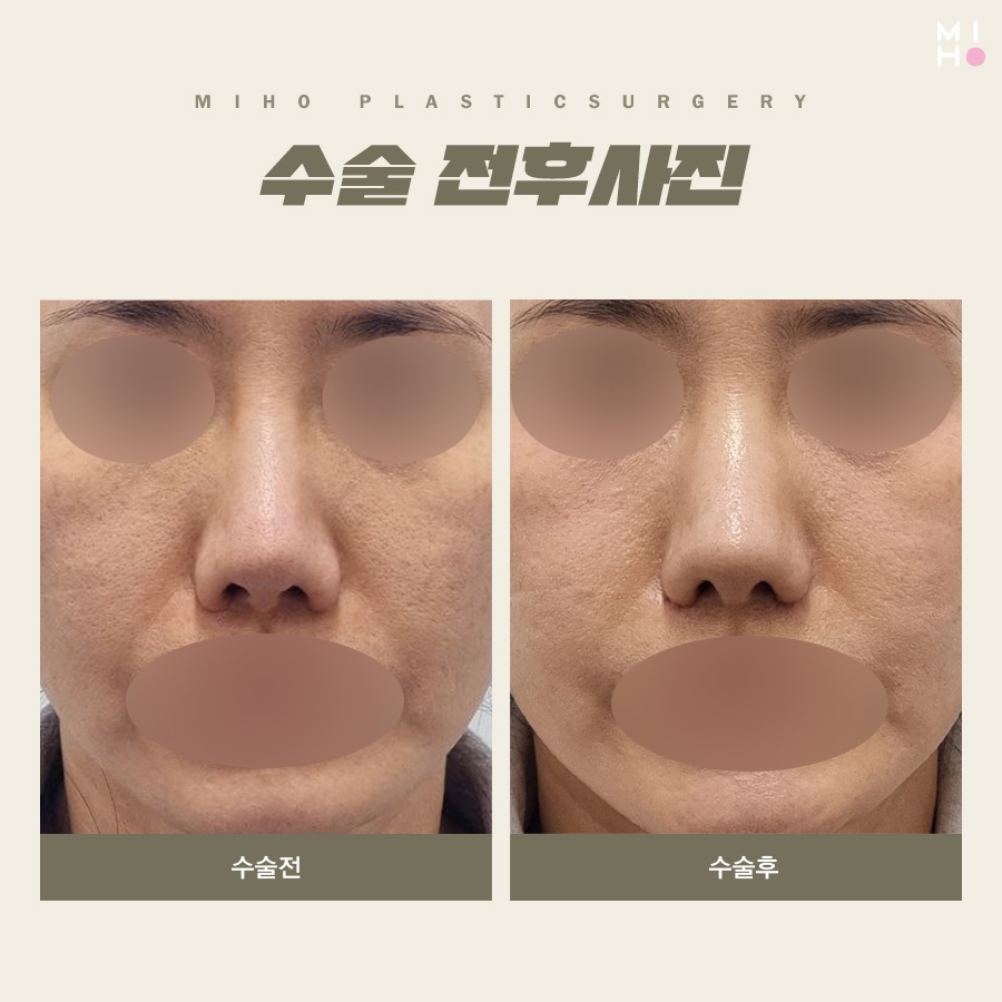 비익거상 깔끔한 과정을 위해서 관련 이미지 8