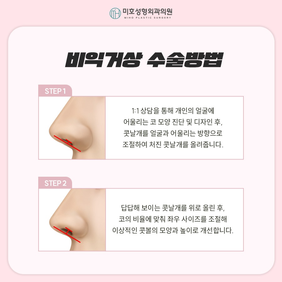 비익거상 맞춤 비율을 찾아주는 미호 관련 이미지 5
