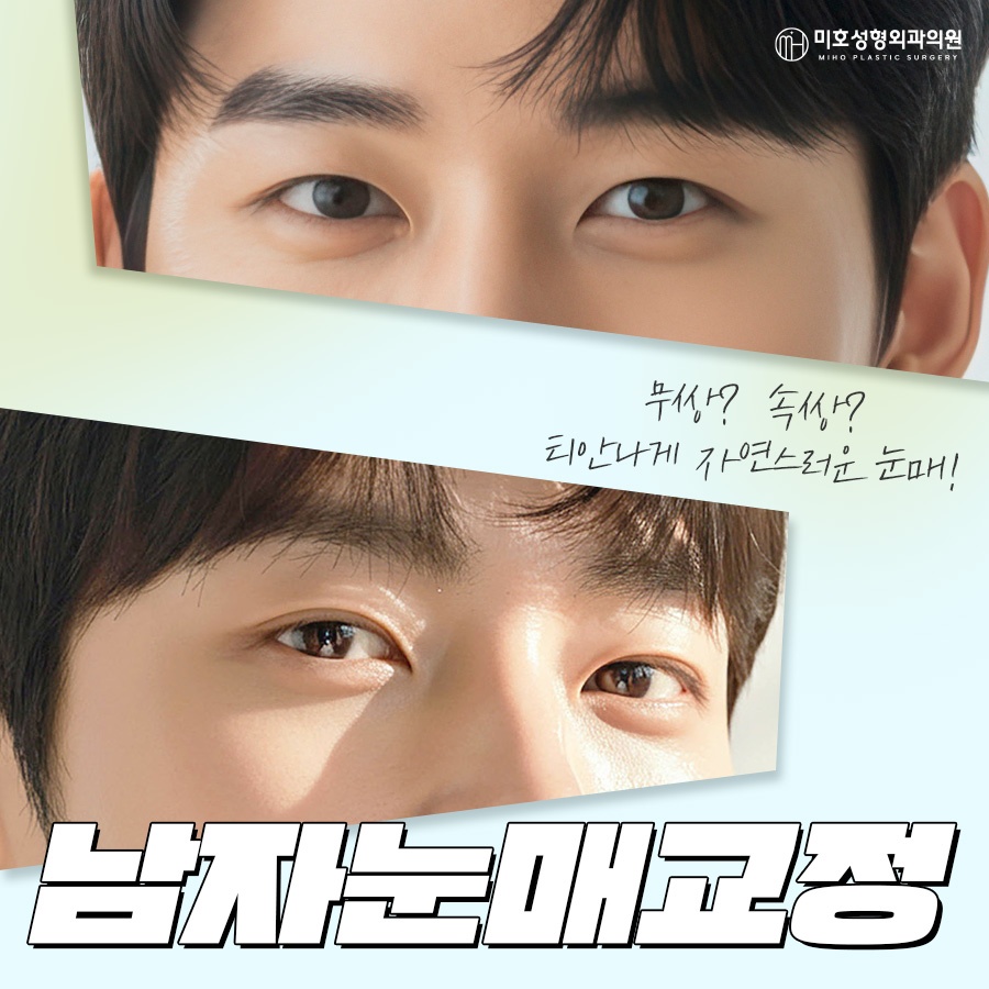 Natural-Looking Male Eye Shape Correction image 1