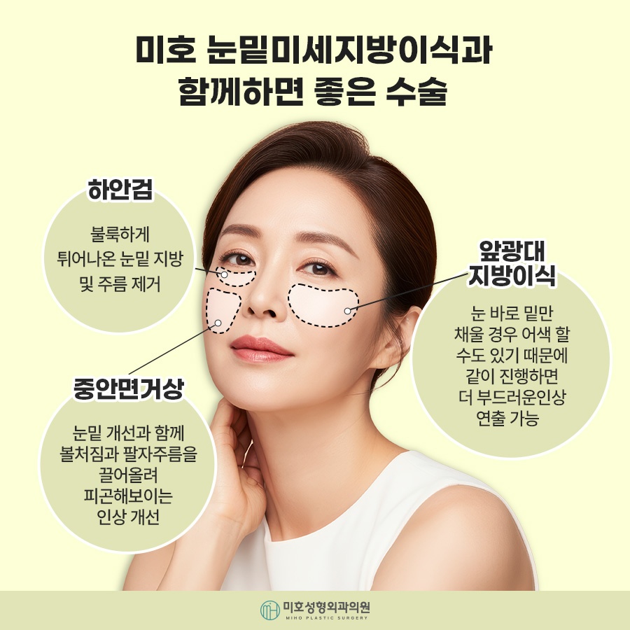 눈밑지방이식 자연스러운 입체감 완성 관련 이미지 6