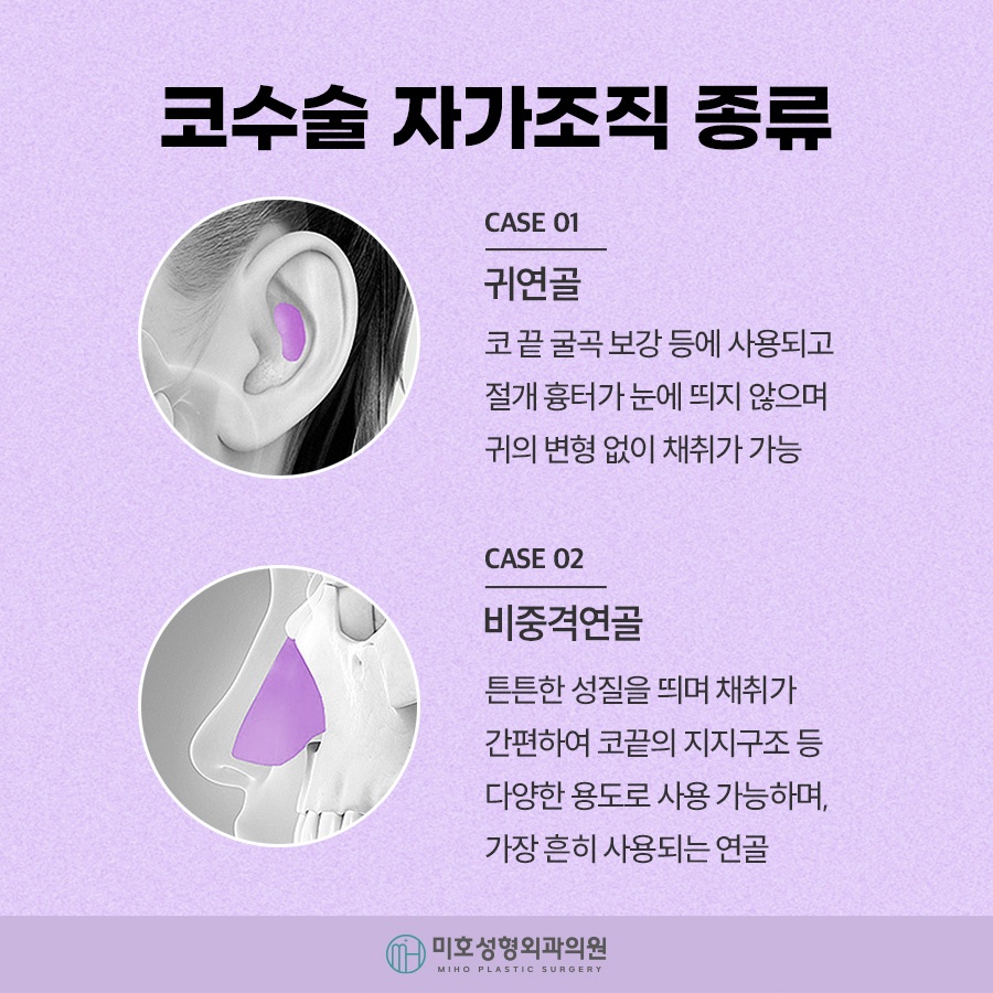 구축코 재시도 신중히 고려하여 관련 이미지 6