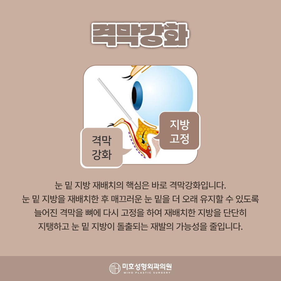 눈밑지붓기 원인 기간을 고려하여 관련 이미지 4