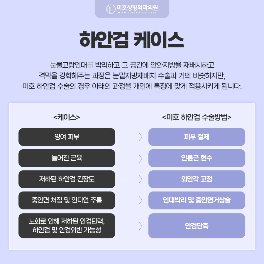 하안검수술 아래쪽 변화가 고민이라면 관련 이미지 3