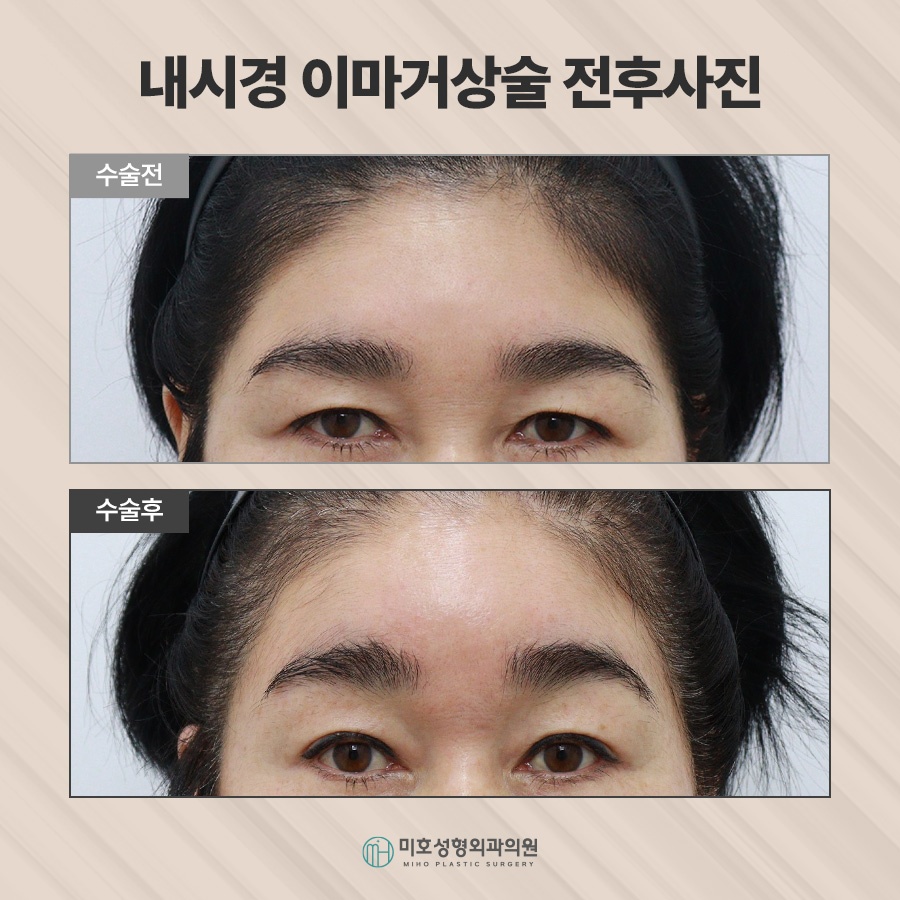 이마거상후기 진행과정 및 체크할 점 관련 이미지 7