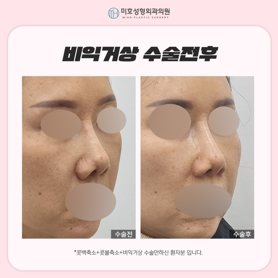 비익거상 맞춤 비율을 찾아주는 미호 관련 이미지 7