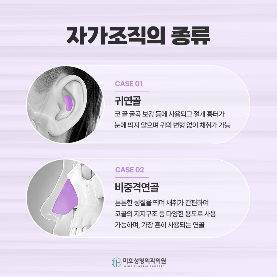 If You Need Contracted Nose Reconstruction image 6
