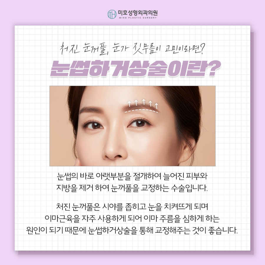 눈썹하거상술 비용과 후기 흉터 궁금하다면 관련 이미지 2