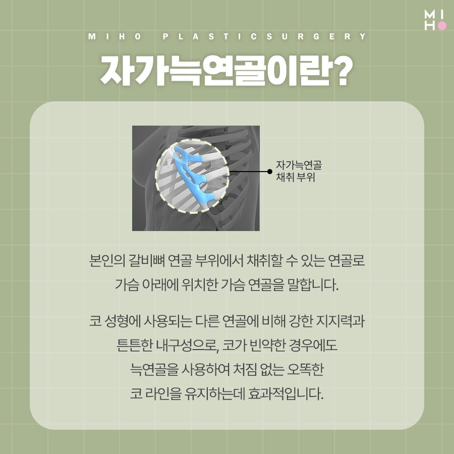 자가늑코수술 나에게 적합한 방식으로 관련 이미지 2