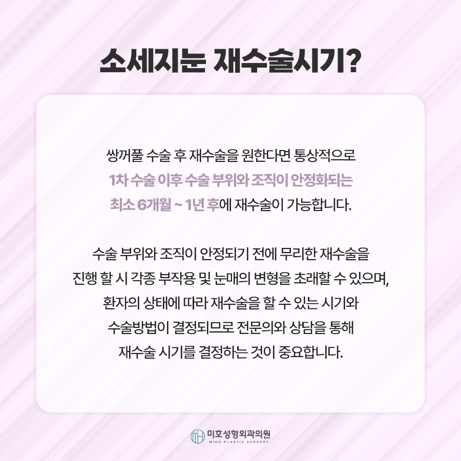 소세지눈재수술 적용 방식 2가지 관련 이미지 5
