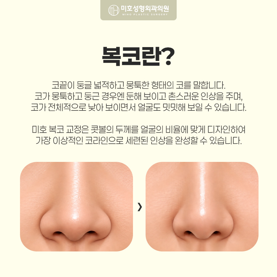 복코교정이란? 복코 원인부터 수술방법, 회복기간까지 알아보기 관련 이미지 2