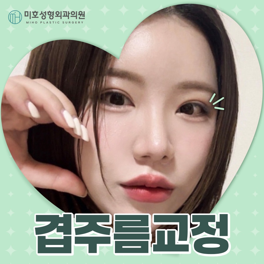 겹주름교정 자연스럽게 완성하려면 관련 이미지 1