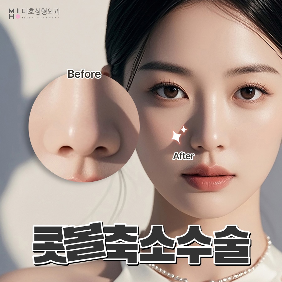 How Alar Reduction Surgery Is Performed and What to Expect in the Future image 1
