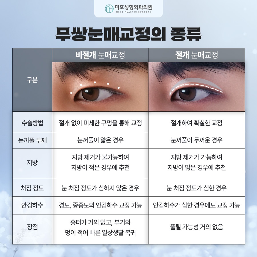 무쌍눈매교정 전후 차이를 비교해보고 관련 이미지 4