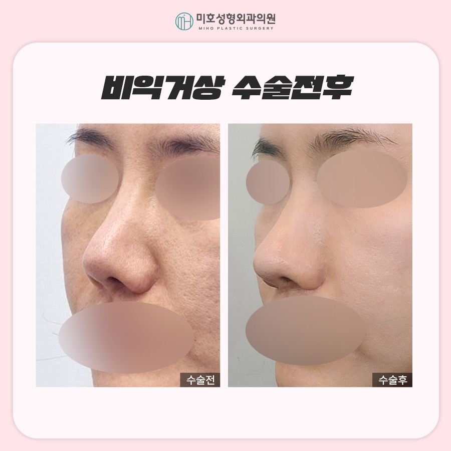 비익거상 맞춤 비율을 찾아주는 미호 관련 이미지 8