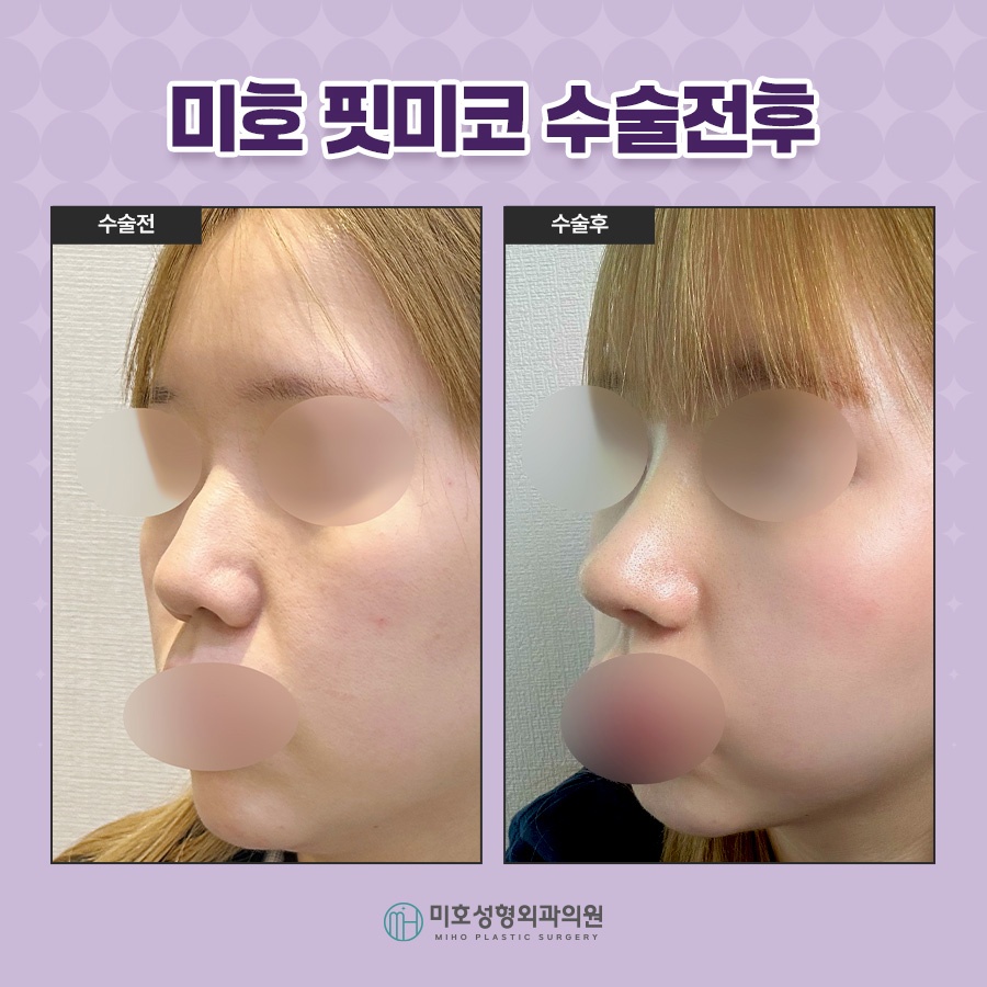 Fit Me Nose, Naturally and Beautifully image 7