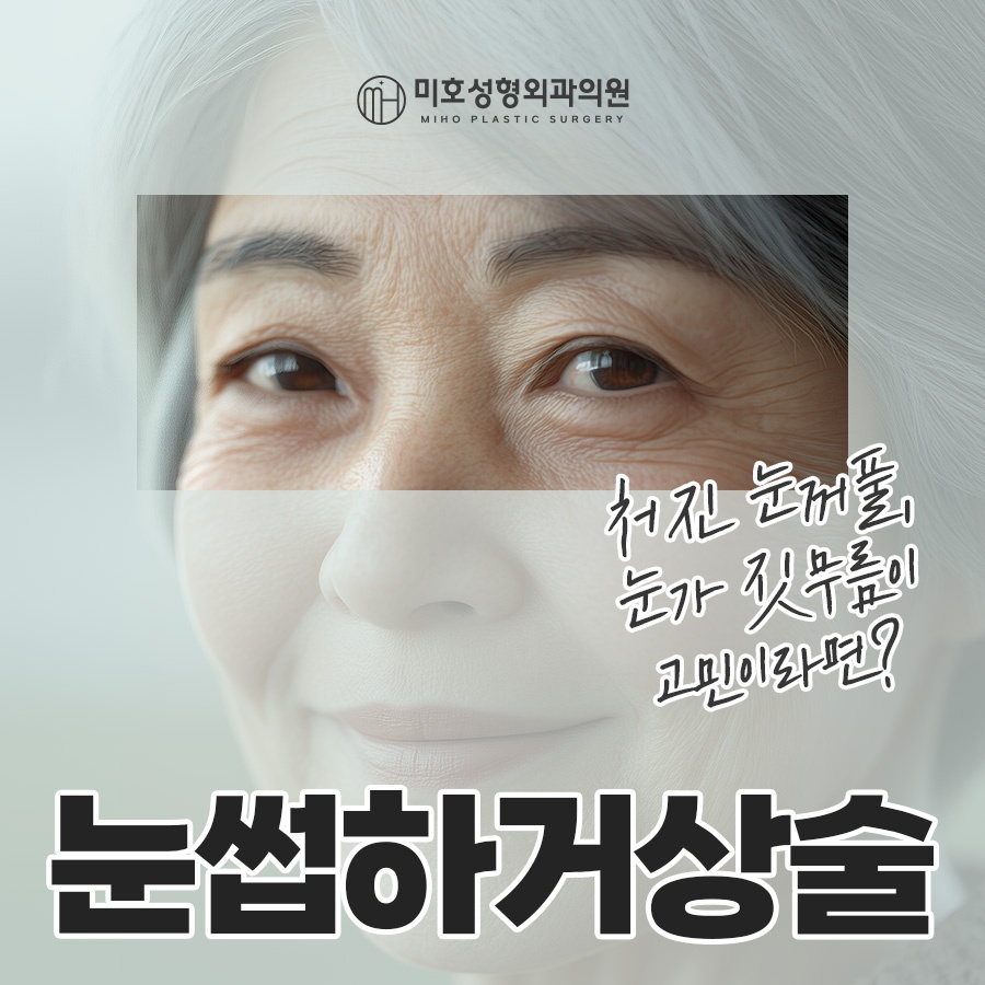 Sub-Brow Lift Scar, Cost, Recovery Process, Information, and Review image 1