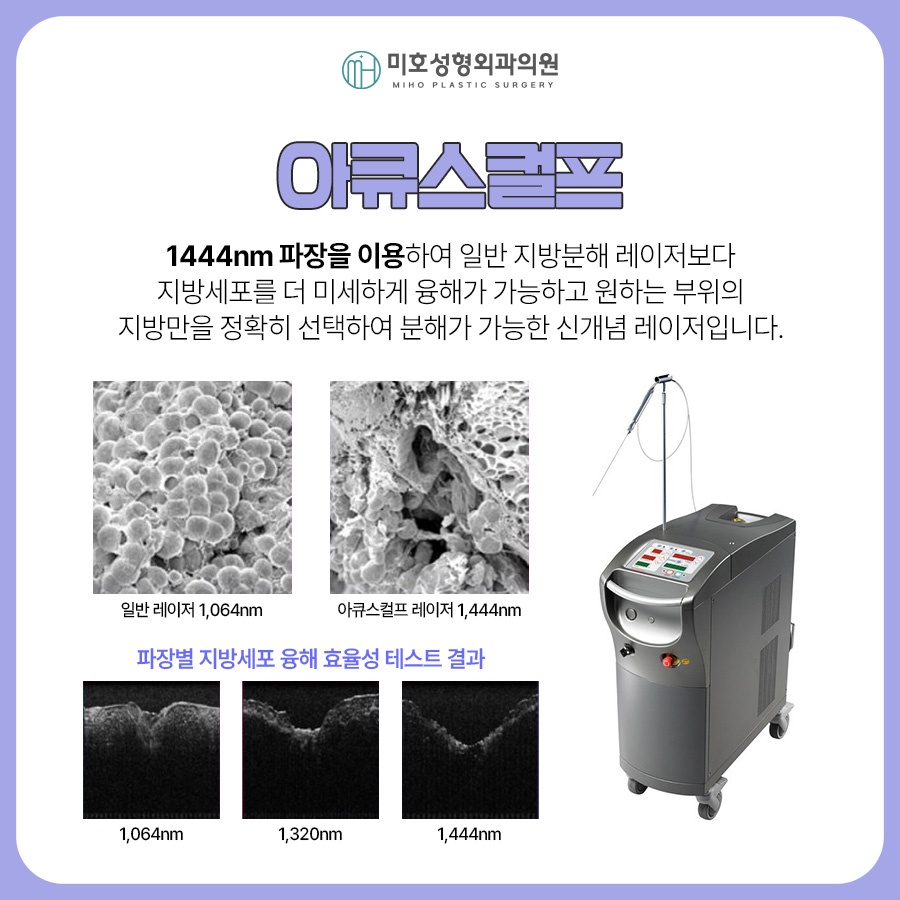 Looking at the Progress of Chin Muscle Ligation for a Double Chin image 6