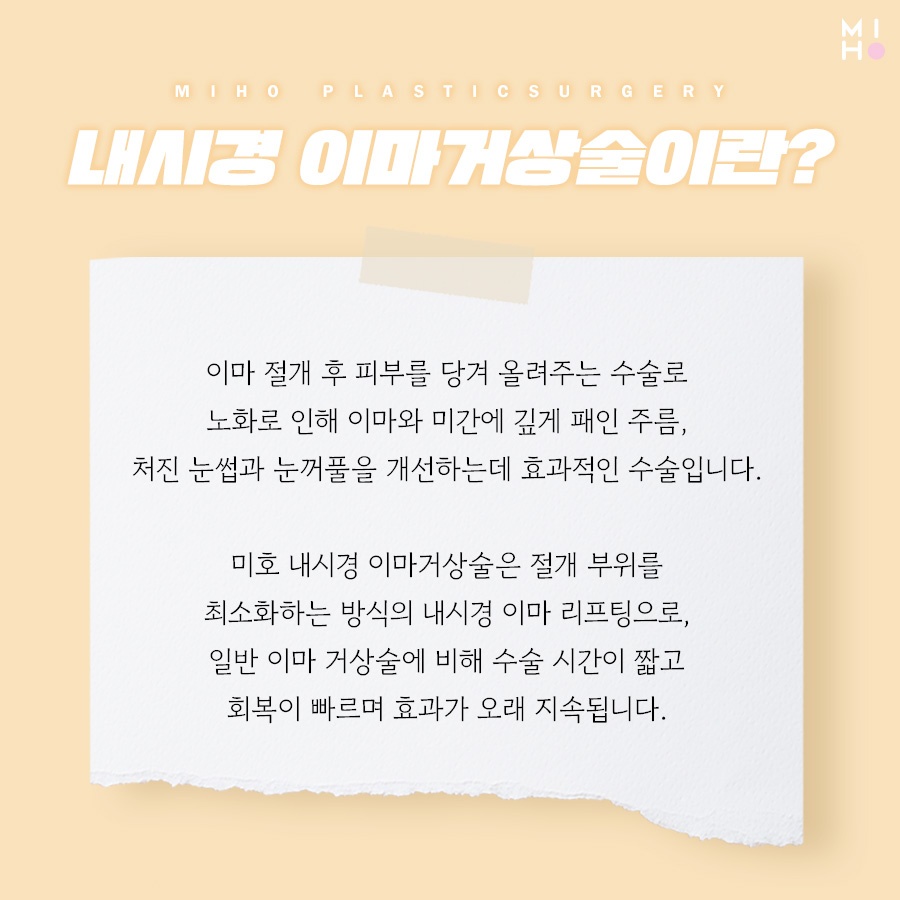 이마거상술후기 고려할 부분은 관련 이미지 2