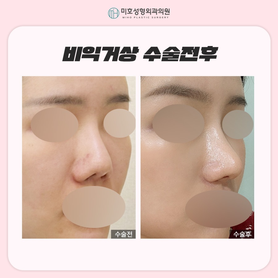 비익거상 맞춤 비율을 찾아주는 미호 관련 이미지 10