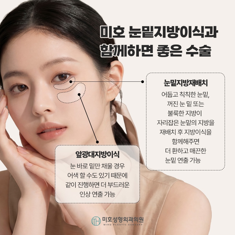 If Under-Eye Fat Grafting Is Stressful Because It Makes You Look Tired image 5