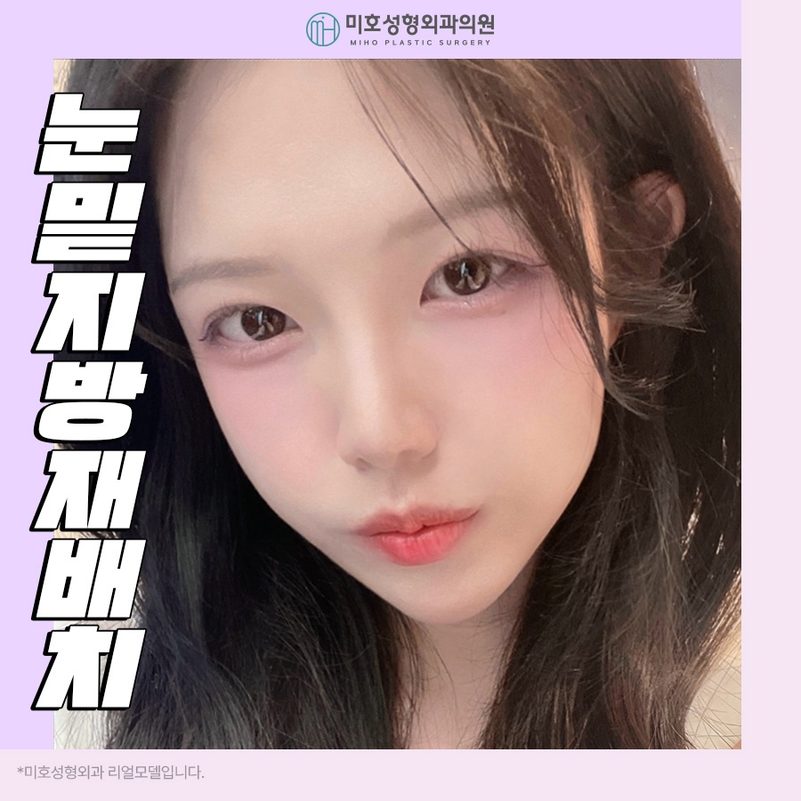 눈밑지방재배치로 젊음을 획득 관련 이미지 1
