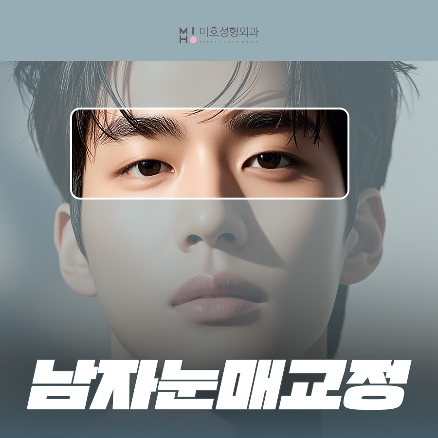 남자눈매교정 무쌍부터 유쌍까지 시원하게 관련 이미지 1