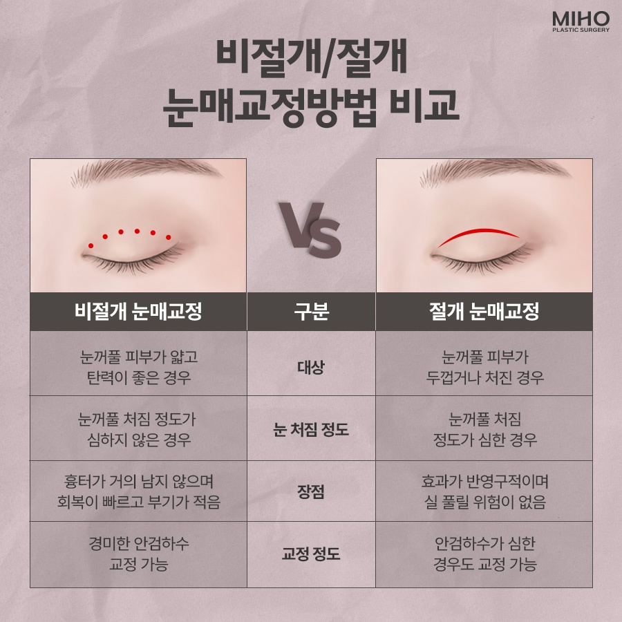 안검하수 발생 요인과 증상에 맞춰 관련 이미지 4