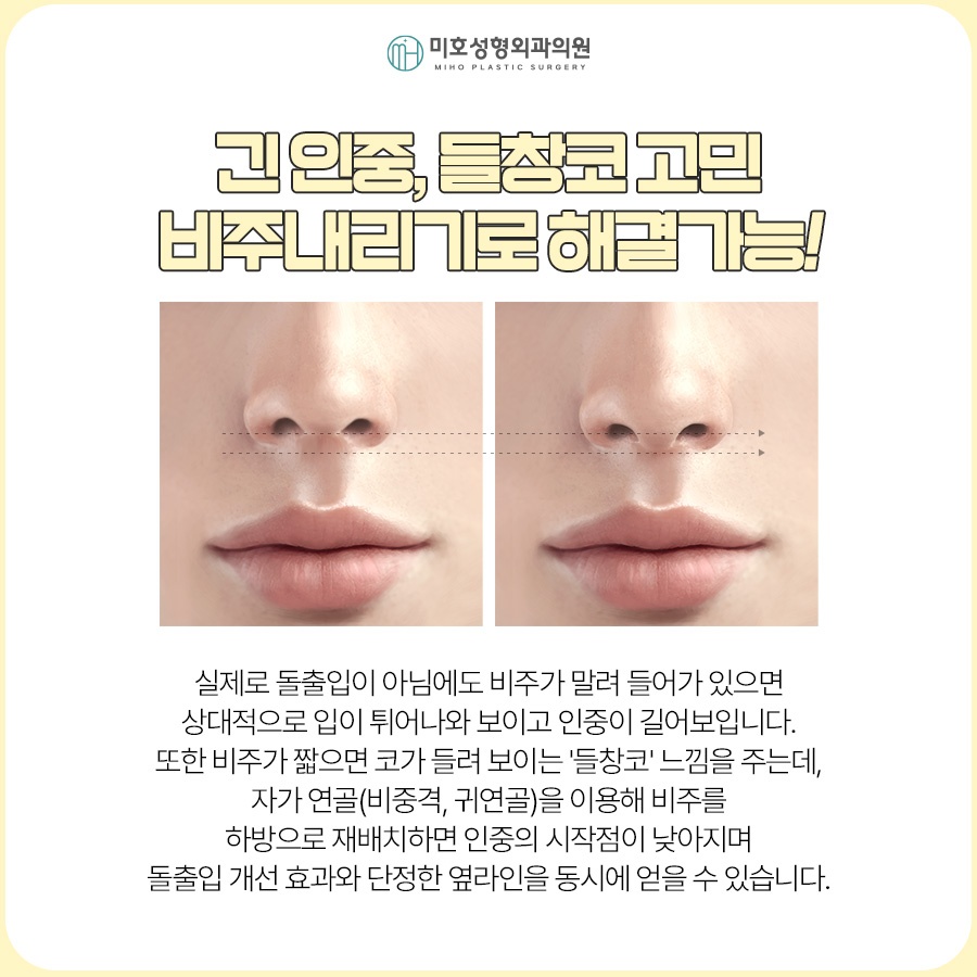 비주내리기 입체적이고 세련된 옆라인을 만드는 방법 관련 이미지 3