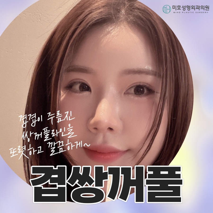 겹쌍꺼풀 깔끔하게 정돈하려면 관련 이미지 1