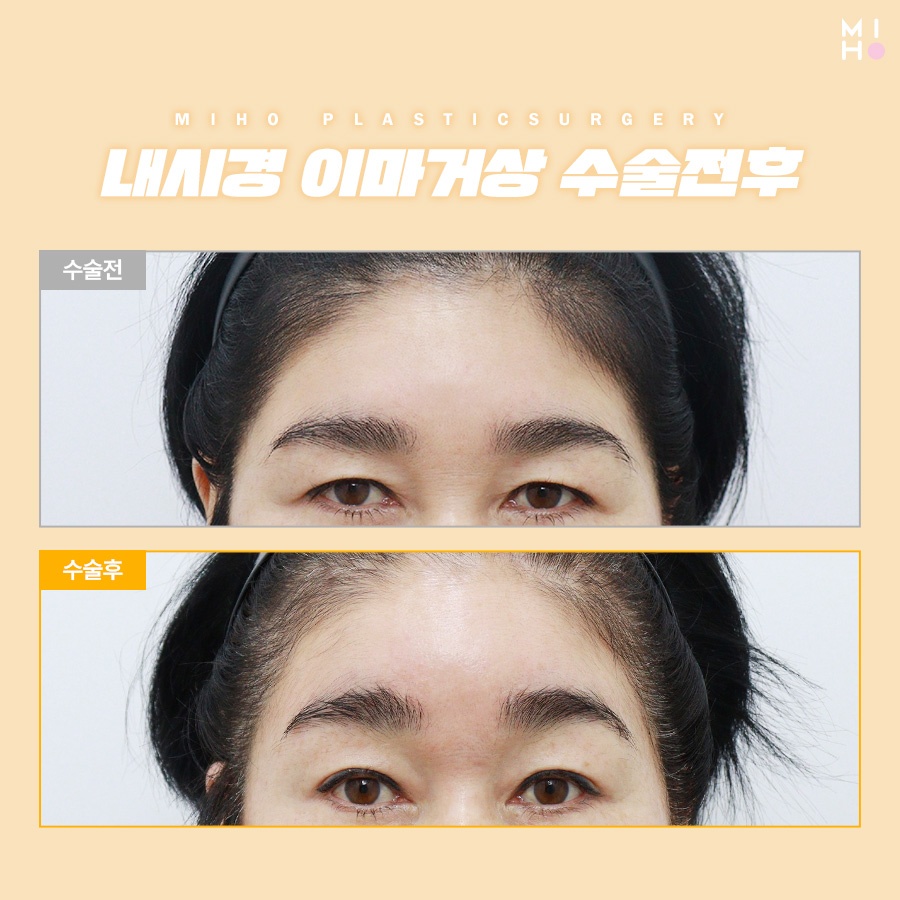 이마거상술후기 고려할 부분은 관련 이미지 9