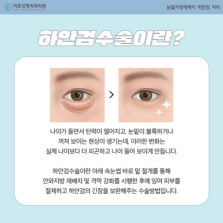 How to Choose Between Under-Eye Fat Repositioning and Lower Blepharoplasty image 3