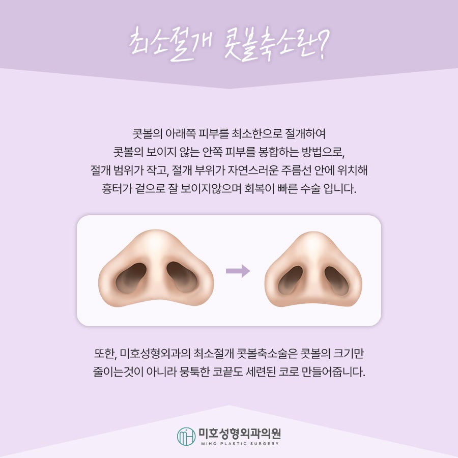 Nasal Alar Reduction in a Natural Direction image 2