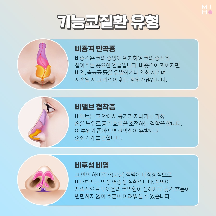Good Results at a Lower Cost with Functional Nasal Surgery Insurance Coverage image 4