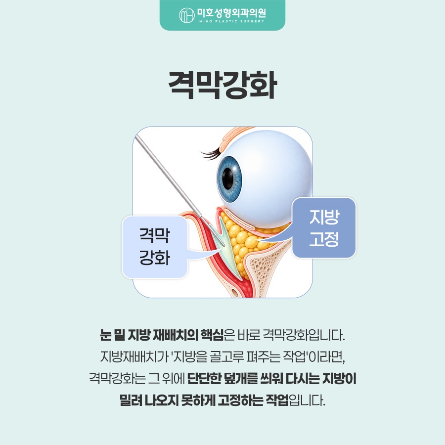 눈밑지방재배치 어두운 인상이 고민이라면 관련 이미지 5