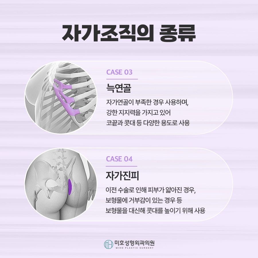 If You Need Contracted Nose Reconstruction image 7