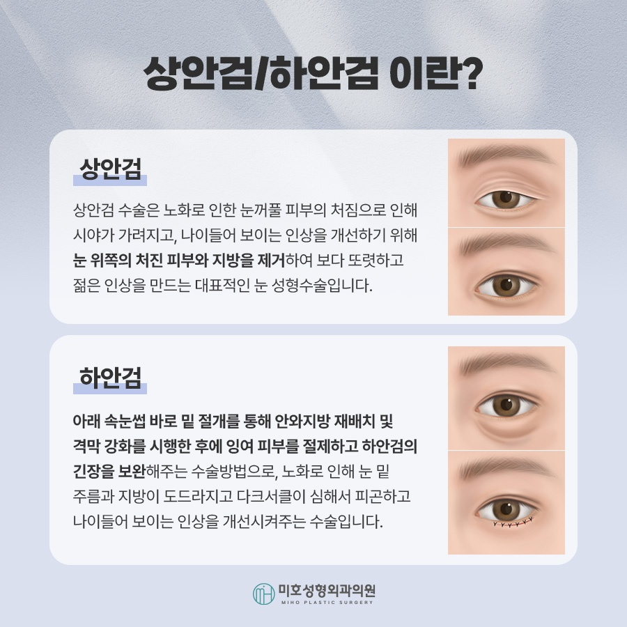 An In-Depth Analysis of Upper and Lower Blepharoplasty image 2