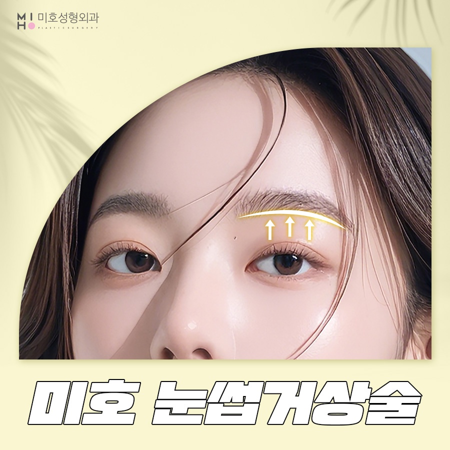 Brow Lift Review: You Could Be the Next Success Story image 1