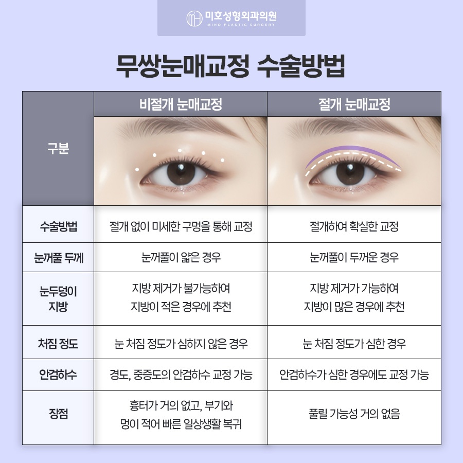 무쌍눈매교정 쌍꺼풀 없이 크고 또렷한 눈으로 관련 이미지 4