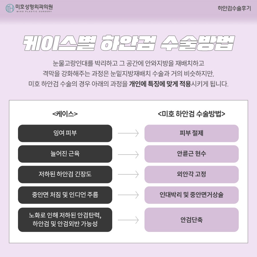 하안검수술후기 주인공이 되는 법 관련 이미지 3