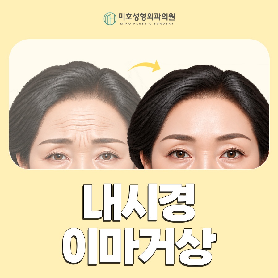 내시경이마거상 부기와 회복기간, 유지기간까지 알아보기 관련 이미지 1